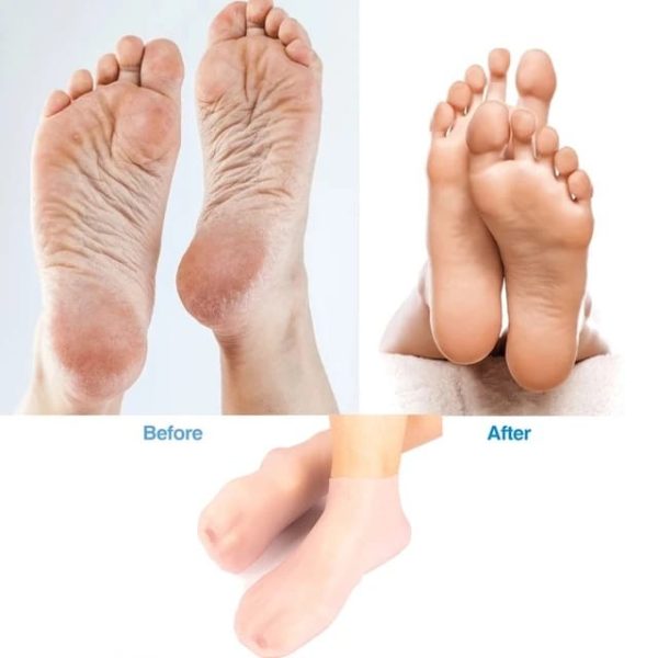 Silicone Jelly Gel Moisturizing Socks